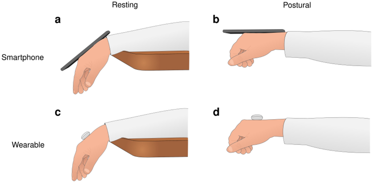 Why Do Hands Shake When Resting on a Table？ Common Causes and Solutions